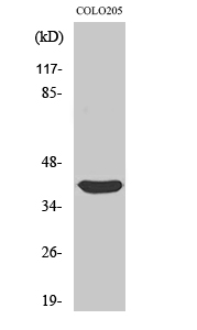Fig. Western Blot analysis of various cells using Siah-2 Polyclonal Antibody.