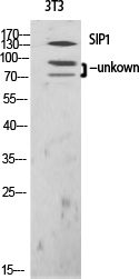 Fig. Western Blot analysis of various cells using SIP1 Polyclonal Antibody diluted at 1:1000.