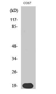 Fig. Western Blot analysis of various cells using Skp1 p19 Polyclonal Antibody.