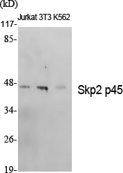 Fig. Western Blot analysis of various cells using Skp2 p45 Polyclonal Antibody diluted at 1:500.