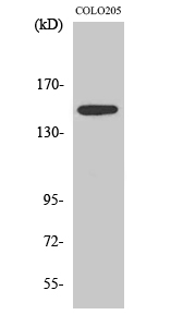 Fig. Western Blot analysis of various cells using SLK Polyclonal Antibody diluted at 1:1000.