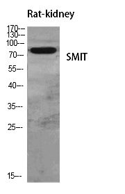 Fig.1. Western Blot analysis of various cells using SMIT Polyclonal Antibody diluted at 1:500.
