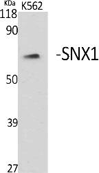Fig. Western Blot analysis of various cells using SNX1 Polyclonal Antibody.
