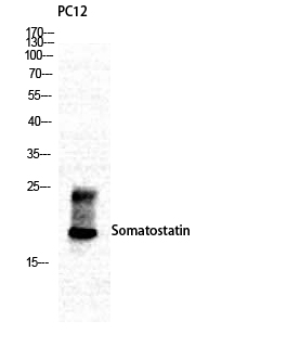 Fig.1. Western Blot analysis of various cells using Somatostatin Polyclonal Antibody.