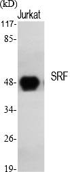 Fig. Western Blot analysis of various cells using SRF Polyclonal Antibody.