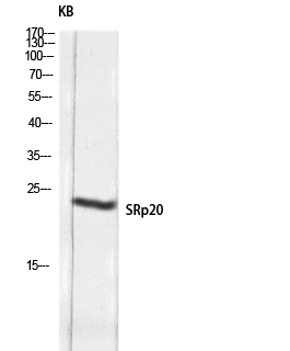 Fig.3. Western blot analysis of KB lysis using SRp20 antibody. Antibody was diluted at 1:2000.