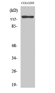 Fig.2. Western Blot analysis of COLO205 cells using ST5 Polyclonal Antibody.