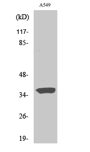Fig. Western Blot analysis of various cells using STEAP1 Polyclonal Antibody.