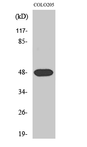 Fig. Western Blot analysis of various cells using Synaptotagmin XI Polyclonal Antibody.