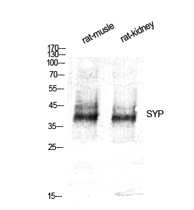 Fig. Western Blot analysis of various cells using SYP Polyclonal Antibody diluted at 1:500.