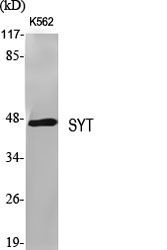 Fig.1. Western Blot analysis of various cells using SYT Polyclonal Antibody.