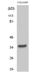 Fig. Western Blot analysis of various cells using T2R8 Polyclonal Antibody.