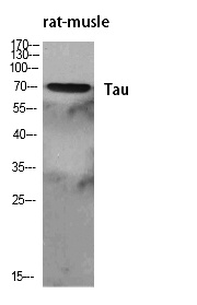 Fig. Western Blot analysis of various cells using Tau Polyclonal Antibody diluted at 1:500.