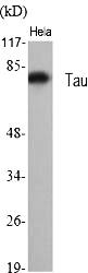 Fig.1. Western Blot analysis of various cells using Tau Polyclonal Antibody diluted at 1:500.