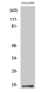 Fig. Western Blot analysis of various cells using TCEAL1 Polyclonal Antibody.