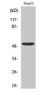 Fig.2. Western Blot analysis of COLO205 cells using TGFβ RI Polyclonal Antibody diluted at 1:500.