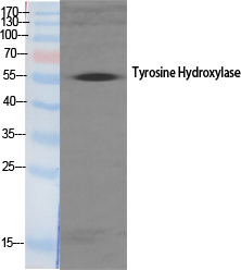 Fig.1. Western Blot analysis of various cells using TH Polyclonal Antibody.