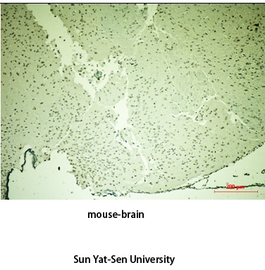 Fig.3. The picture was kindly provided by our customer.