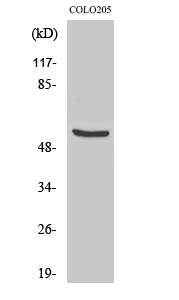 Fig. Western Blot analysis of various cells using TH Polyclonal Antibody.