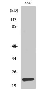 Fig. Western Blot analysis of various cells using TIMP-2 Polyclonal Antibody diluted at 1:1000. Secondary antibody (catalog#: A21020) was diluted at 1:20000.