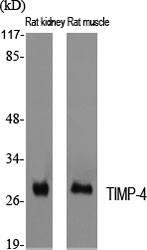Fig. Western Blot analysis of various cells using TIMP-4 Polyclonal Antibody diluted at 1:2000. Secondary antibody (catalog#: A21020) was diluted at 1:20000.