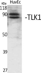Fig. Western Blot analysis of various cells using TLK1 Polyclonal Antibody. Secondary antibody (catalog#: A21020) was diluted at 1:20000.