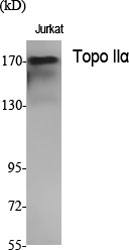 Fig.1. Western Blot analysis of various cells using Topo IIα Polyclonal Antibody diluted at 1:1000. Secondary antibody (catalog#: A21020) was diluted at 1:20000.