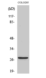Fig. Western Blot analysis of various cells using TP53INP1 Polyclonal Antibody diluted at 1:1000. Secondary antibody (catalog#: A21020) was diluted at 1:20000.
