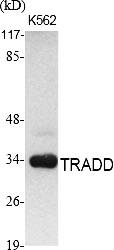 Fig.1. Western Blot analysis of various cells using TRADD Polyclonal Antibody. Secondary antibody (catalog#: A21020) was diluted at 1:20000.