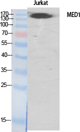 Fig. Western Blot analysis of various cells using TRAP220 Polyclonal Antibody diluted at 1:500. Secondary antibody (catalog#: A21020) was diluted at 1:20000.
