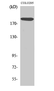 Fig. Western Blot analysis of various cells using TRAP220 Polyclonal Antibody. Secondary antibody (catalog#: A21020) was diluted at 1:20000.