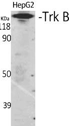 Fig.1. Western Blot analysis of various cells using Trk B Polyclonal Antibody diluted at 1:500. Secondary antibody (catalog#: A21020) was diluted at 1:20000.