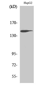 Fig.2. Western Blot analysis of HepG2 cells using Trk B Polyclonal Antibody diluted at 1:500. Secondary antibody (catalog#: A21020) was diluted at 1:20000.