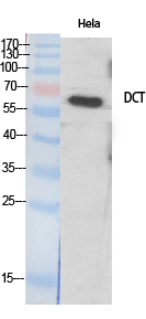 Fig. Western Blot analysis of various cells using TRP2 Polyclonal Antibody diluted at 1:500. Secondary antibody (catalog#: A21020) was diluted at 1:20000.
