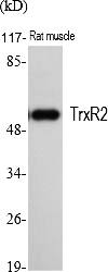 Fig.1. Western Blot analysis of various cells using TrxR2 Polyclonal Antibody. Secondary antibody (catalog#: A21020) was diluted at 1:20000.