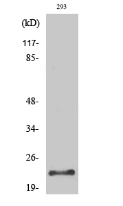Fig. Western Blot analysis of various cells using Trypsin-1 Polyclonal Antibody diluted at 1:500. Secondary antibody (catalog#: A21020) was diluted at 1:20000.