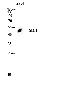 Fig.2. Western blot analysis of 293T lysis using TSLC1 antibody. Antibody was diluted at 1:500. Secondary antibody (catalog#: A21020) was diluted at 1:20000.
