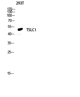 Fig.3. Western blot analysis of 293T lysis using TSLC1 antibody. Antibody was diluted at 1:500. Secondary antibody (catalog#: A21020) was diluted at 1:20000.
