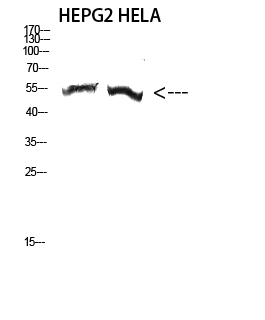 Fig.2. Western Blot analysis of HepG2,  hela cells using Antibody diluted at 1:2000. Secondary antibody (catalog#: A21020) was diluted at 1:20000.