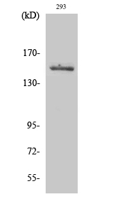 Fig. Western Blot analysis of various cells using Tyk 2 Polyclonal Antibody diluted at 1:2000. Secondary antibody (catalog#: A21020) was diluted at 1:20000.