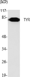 Fig.1. Western Blot analysis of various cells using TYR Polyclonal Antibody. Secondary antibody (catalog#: A21020) was diluted at 1:20000.