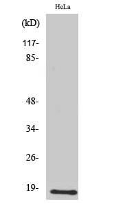 Fig. Western Blot analysis of various cells using UBE2D2 Polyclonal Antibody diluted at 1:2000. Secondary antibody (catalog#: A21020) was diluted at 1:20000.