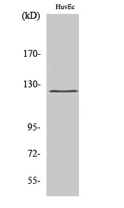 Fig.2. Western Blot analysis of HUVEC cells using UBE3C Polyclonal Antibody. Secondary antibody (catalog#: A21020) was diluted at 1:20000.