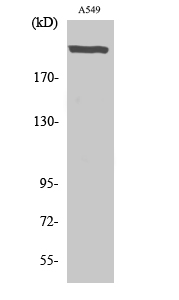 Fig. Western Blot analysis of various cells using UBR5 Polyclonal Antibody. Secondary antibody (catalog#: A21020) was diluted at 1:20000.