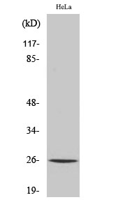 Fig. Western Blot analysis of various cells using UMP-CMP Kinase Polyclonal Antibody diluted at 1:500. Secondary antibody (catalog#: A21020) was diluted at 1:20000.