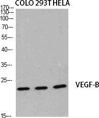 Fig.1. Western Blot analysis of various cells using VEGF-B Polyclonal Antibody diluted at 1:2000. Secondary antibody (catalog#: A21020) was diluted at 1:20000.