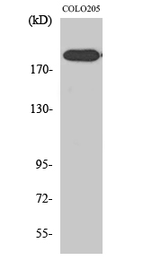Fig. Western Blot analysis of various cells using XPG Polyclonal Antibody diluted at 1:2000. Secondary antibody (catalog#: A21020) was diluted at 1:20000.