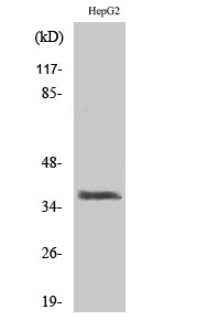 Fig. Western Blot analysis of various cells using XRCC3 Polyclonal Antibody. Secondary antibody (catalog#: A21020) was diluted at 1:20000.
