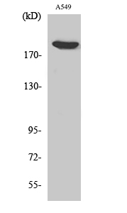 Fig. Western Blot analysis of various cells using ZC3H13 Polyclonal Antibody. Secondary antibody (catalog#: A21020) was diluted at 1:20000.