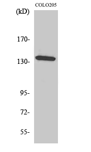 Fig. Western Blot analysis of various cells using α-protein Kinase 1 Polyclonal Antibody. Secondary antibody (catalog#: A21020) was diluted at 1:20000.